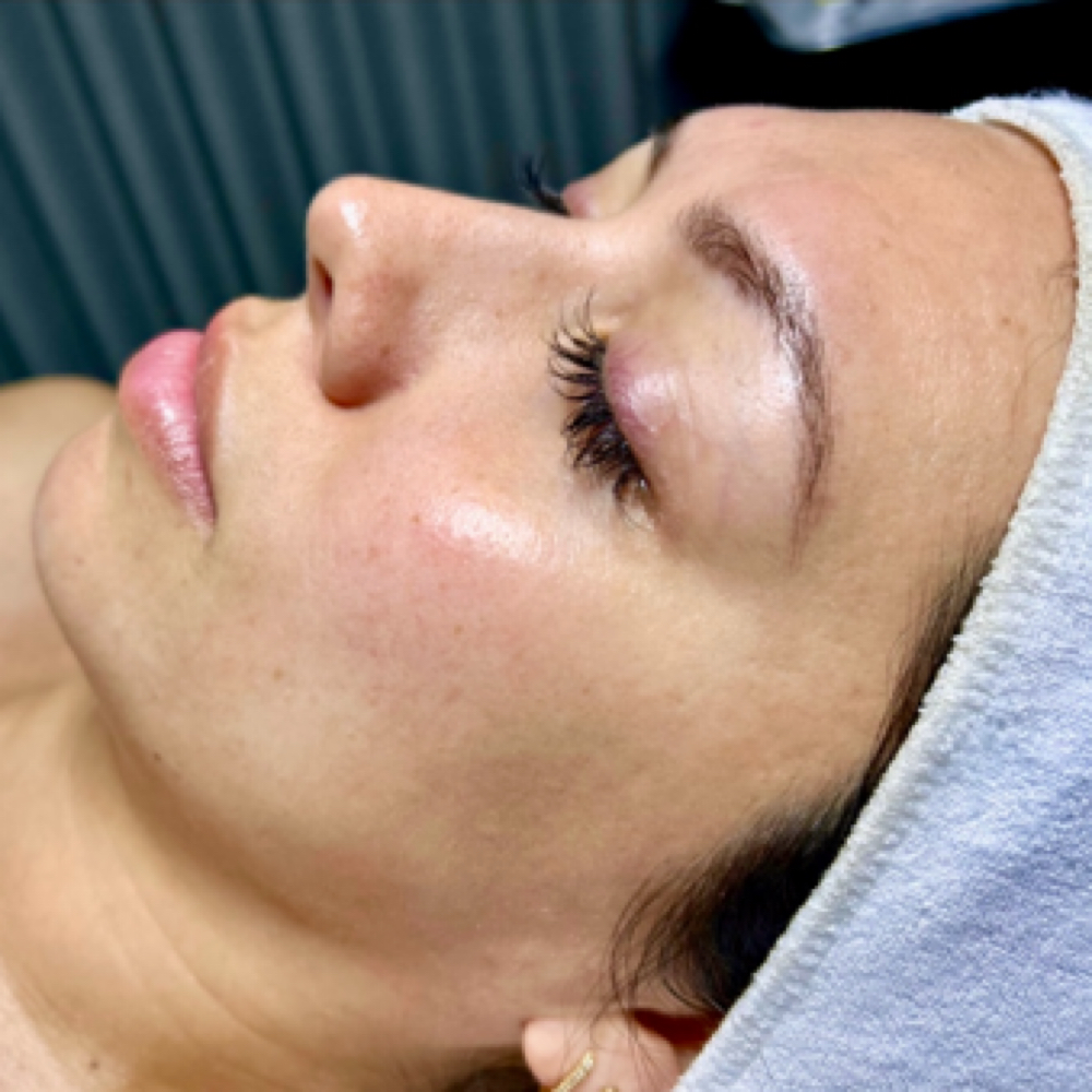 Wet Microdermabrasion at L.R Beauty Bar in Fresno, CA