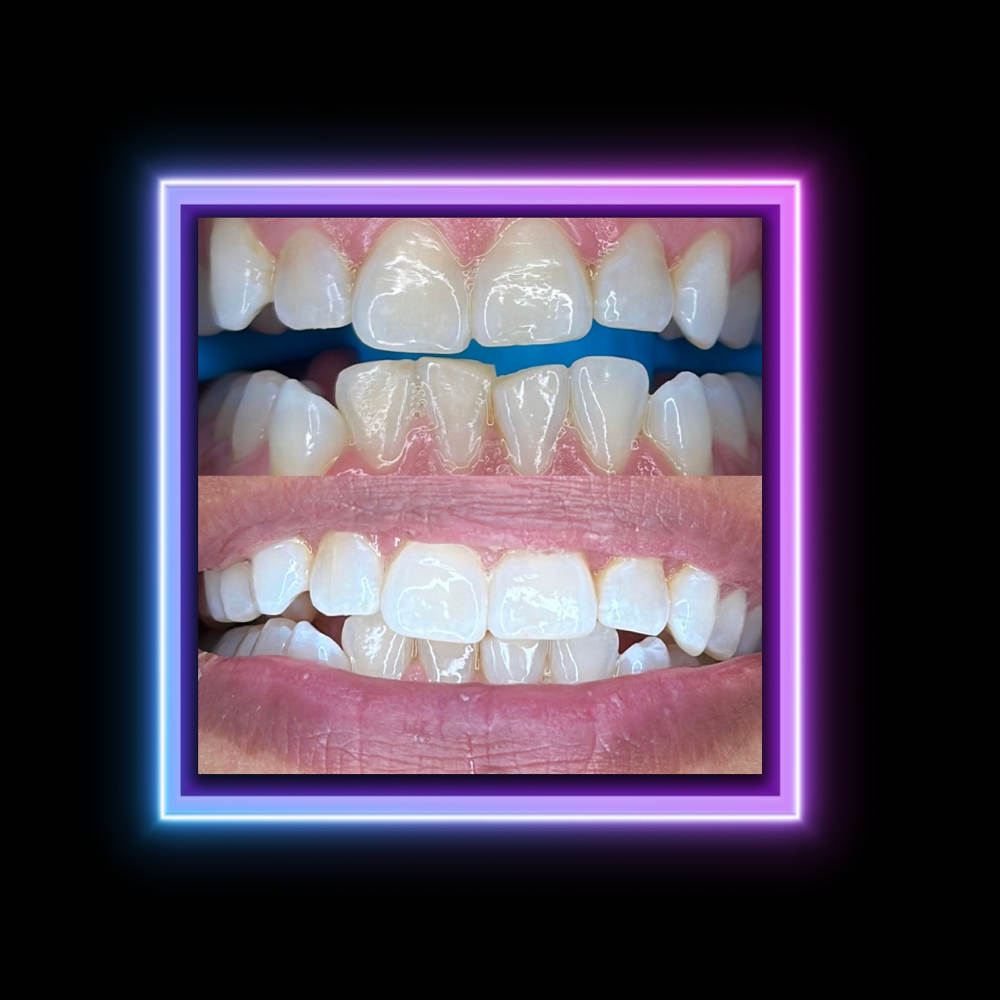 Ultra Glowup Session