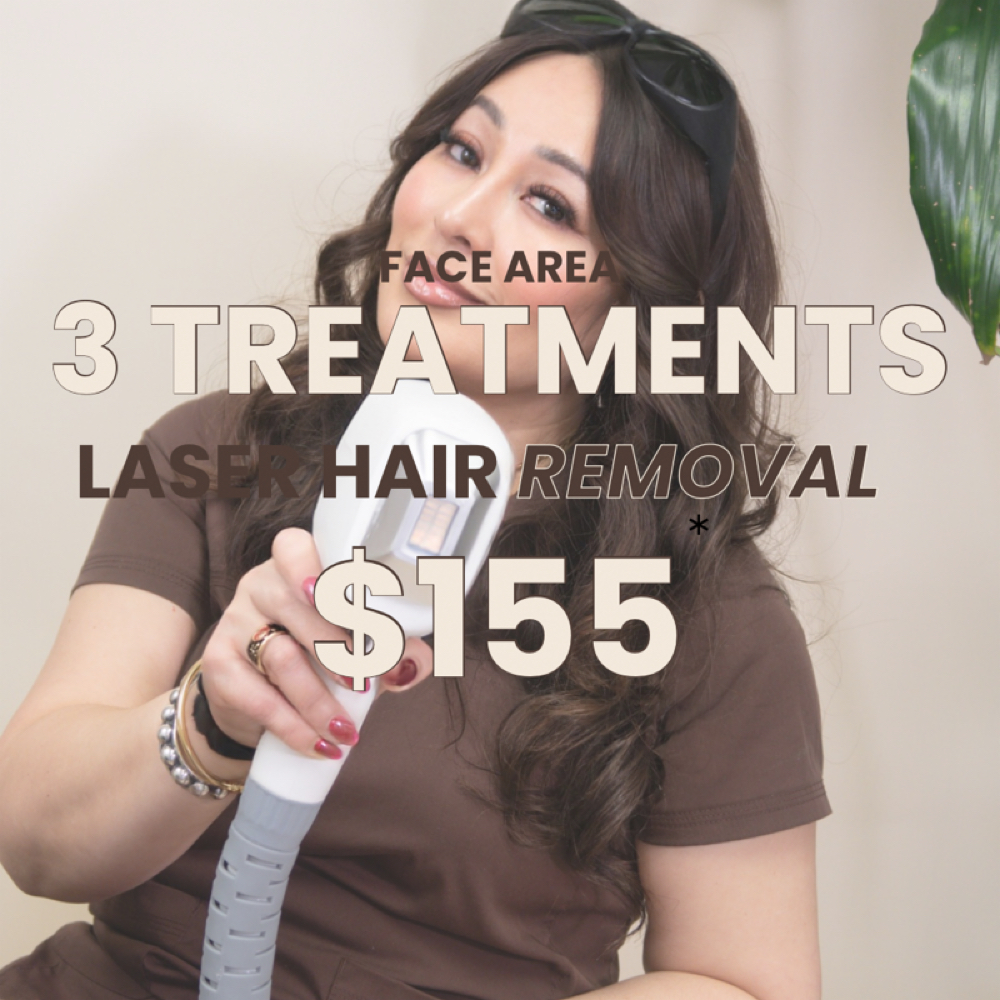 Face Area 3 Laser Treatmets at Solo Skin Studio in Nashville, TN