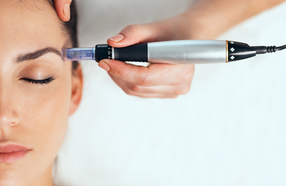 Nano Needling Therapy
