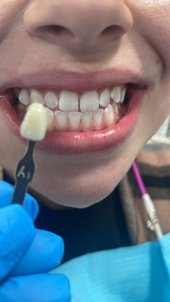 RETURNING CLIENTS TEETH WHITENING at Rivas glam studio in Sicklerville, NJ