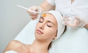 Chemical Peel