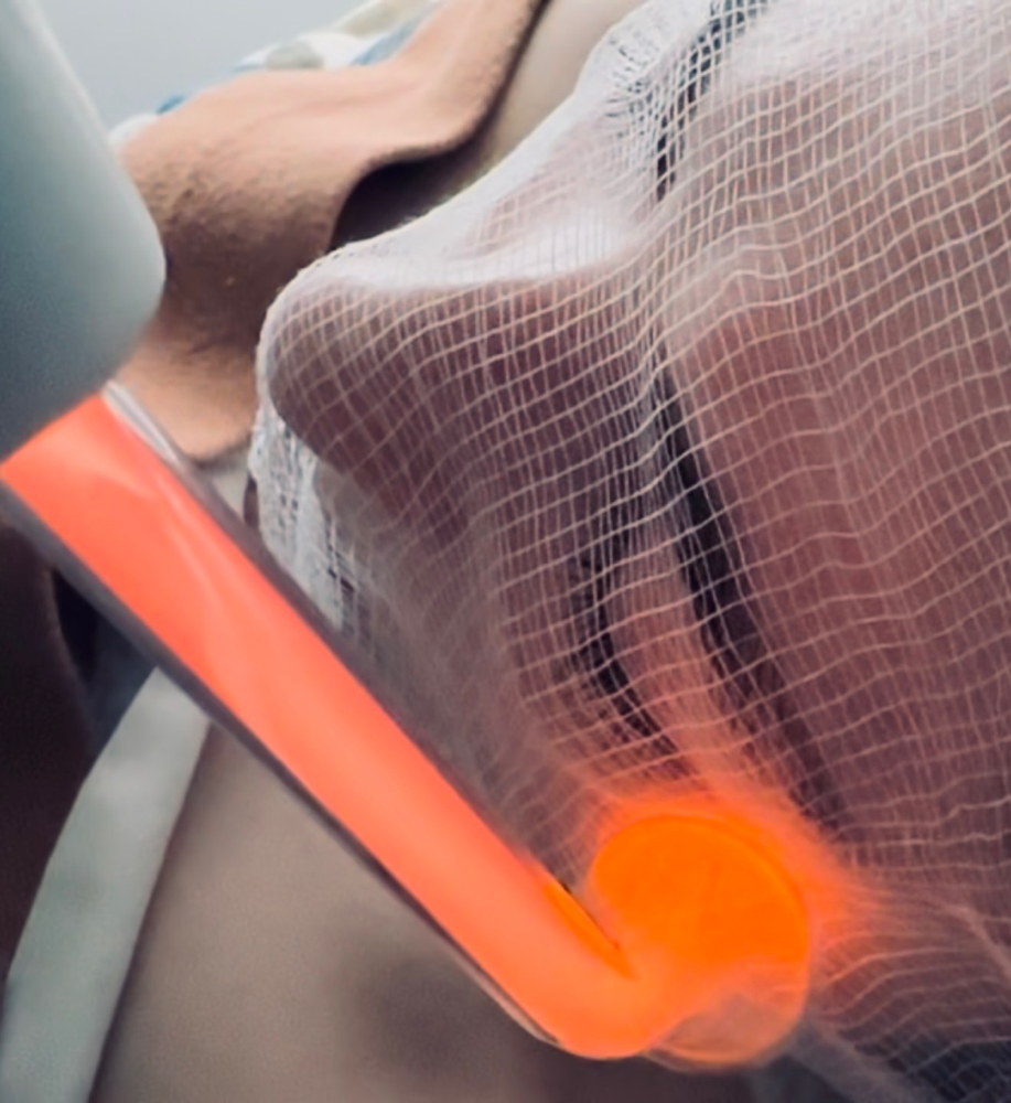 High Frequency ADD ON