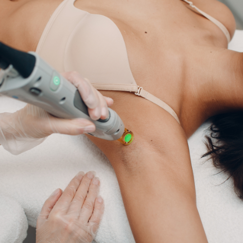 Laser Hair Removal - Medium Area