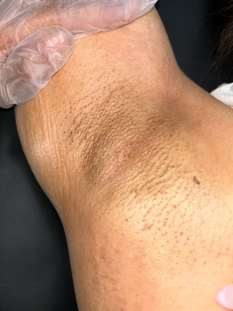 Underarm Wax