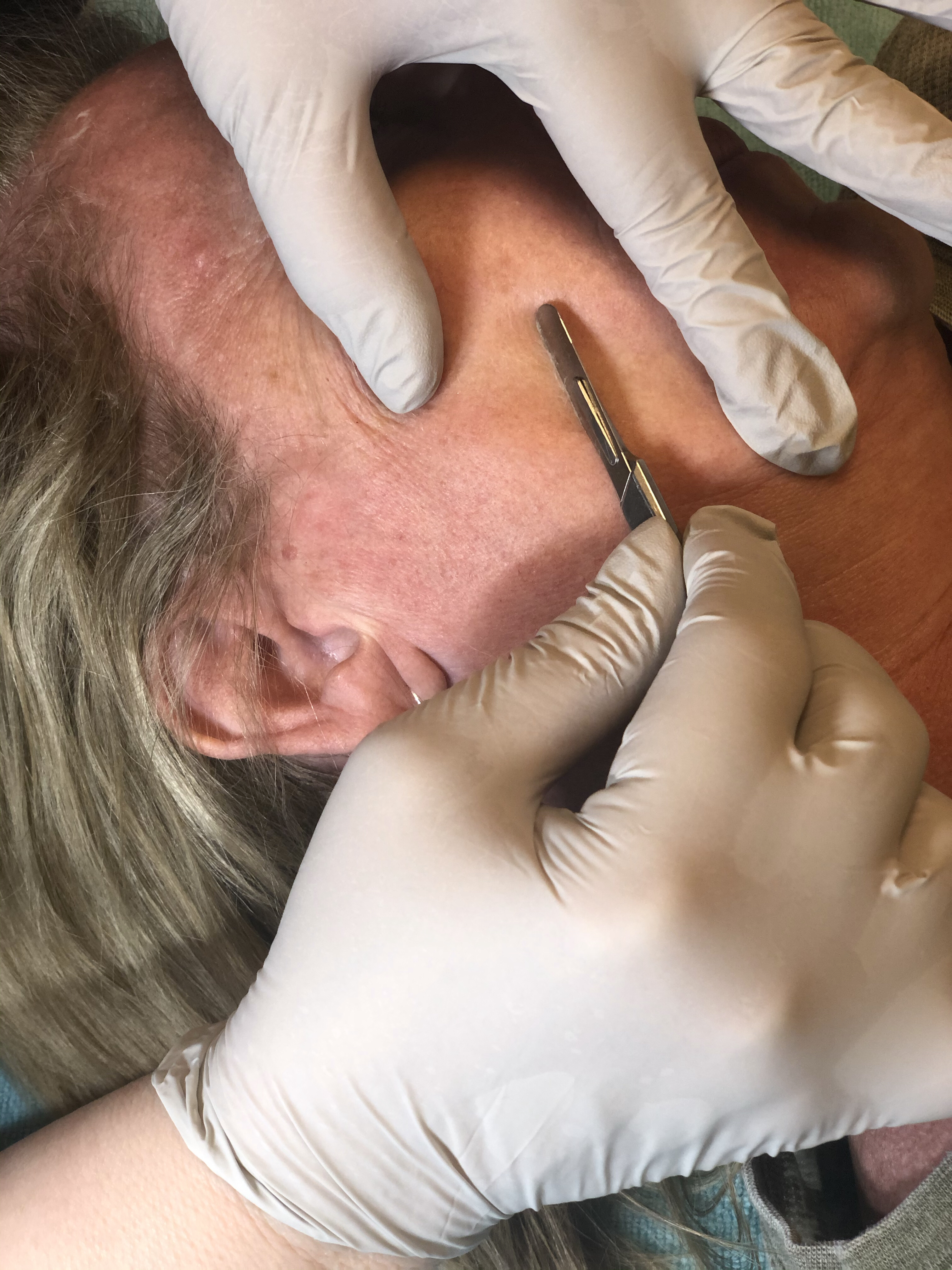 Dermaplane Express Facial