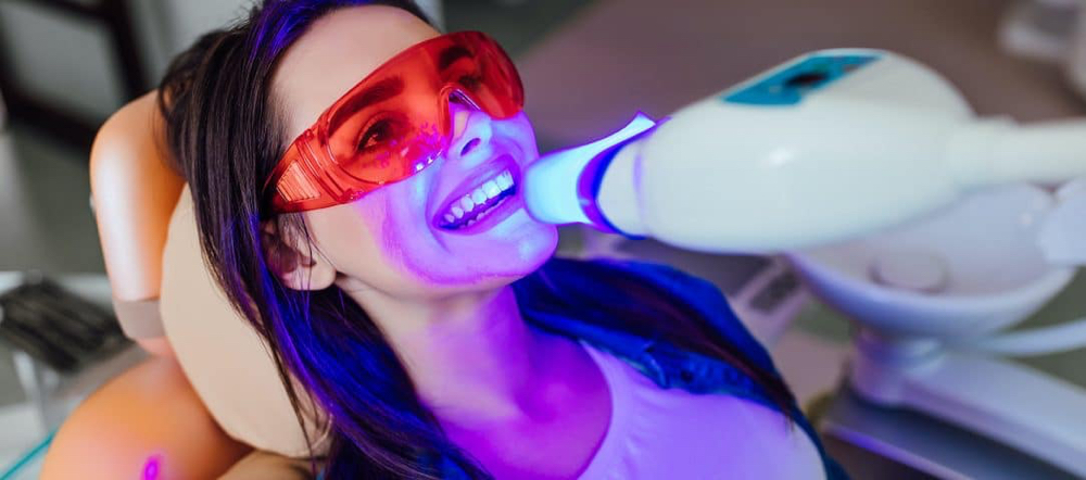 Laser Teeth Whitening 1Hr  20/20/20