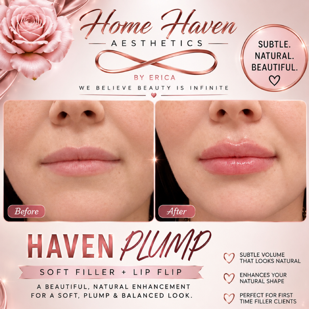 Lip Filler RHA- Promo at Home Haven Aesthetics, LLC in Edinburg, TX