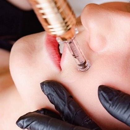 Needle-Free Wrinkle Filler at Bayou Glow, LLC in Larose, LA