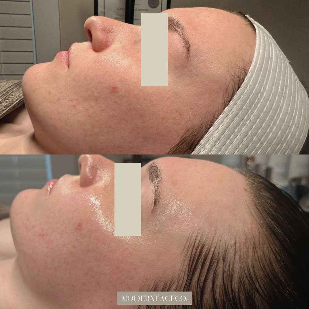 Pumpkin Exfoliating Facial