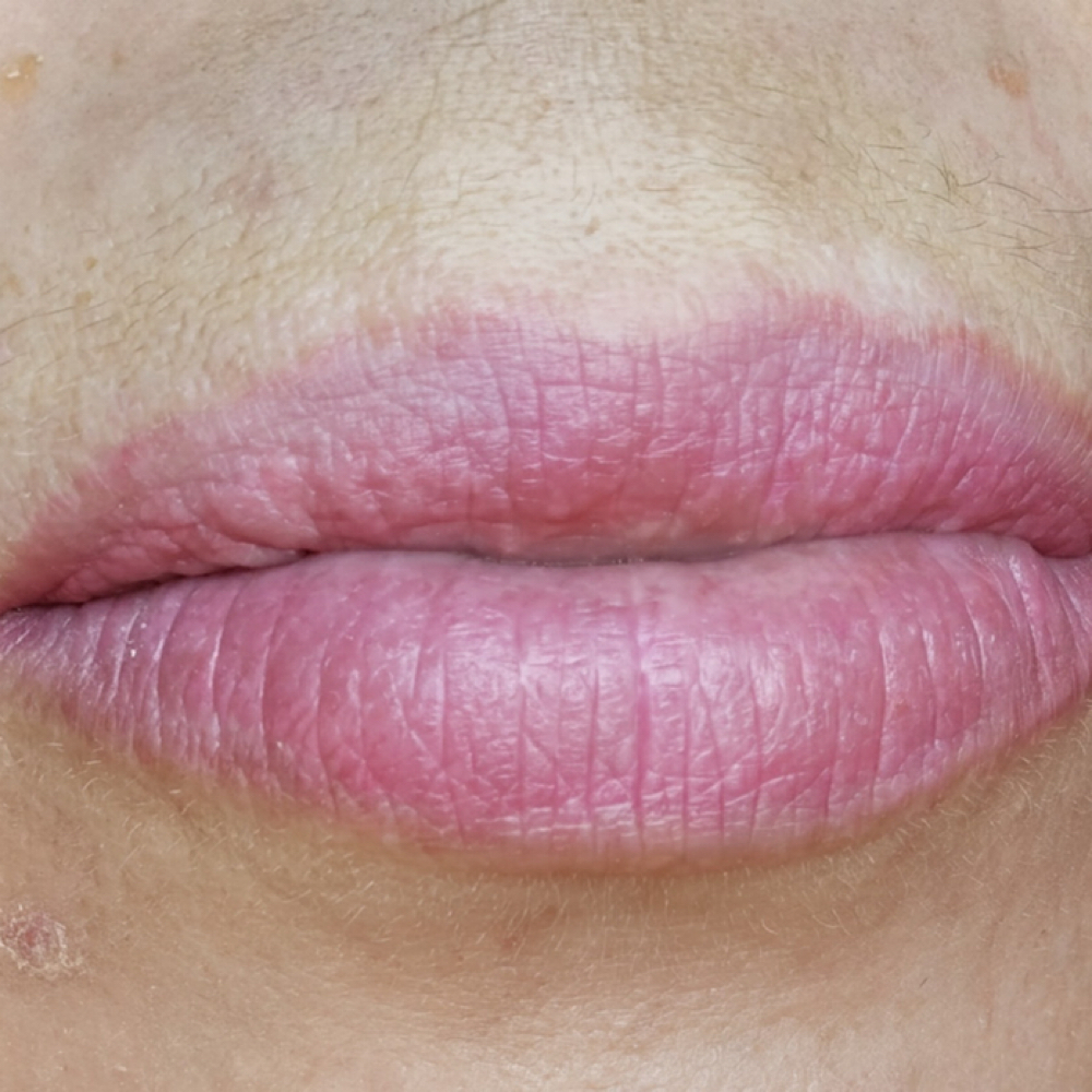Full Lip Color at Holistic Skin Center in Edgewater, FL