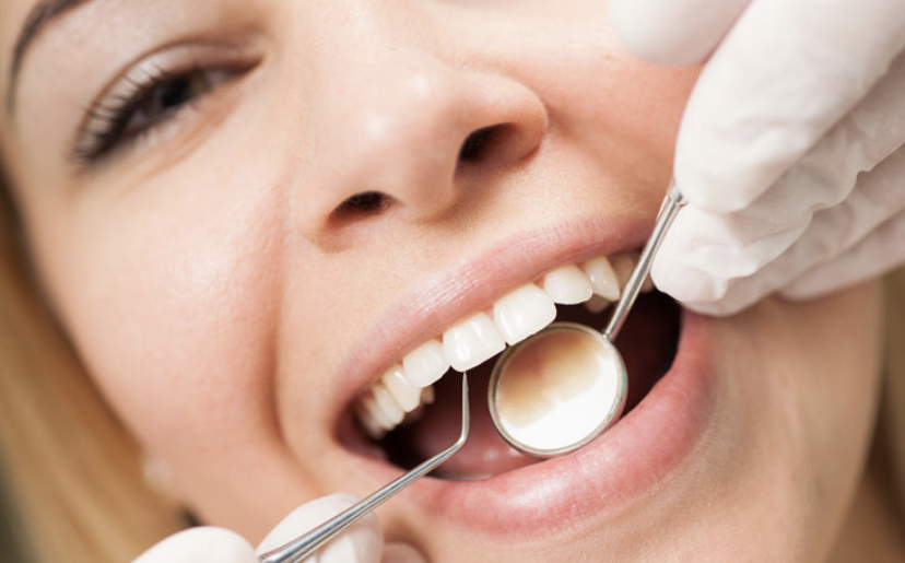 Cleaning & 30min Whitening