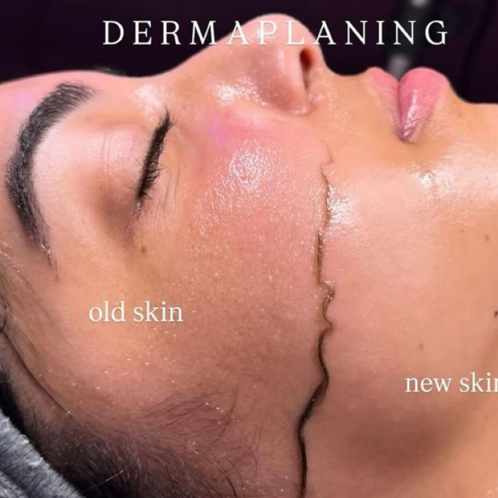 Dermaplane Course at Liz_Skin_Beauty in Joliet, IL