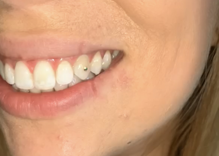 Swarovski Tooth Gem