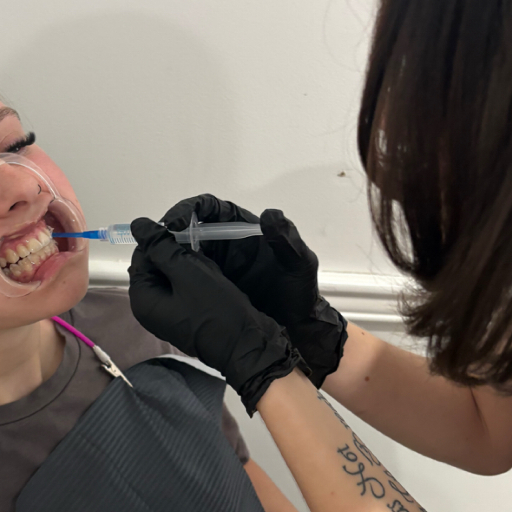 Signature Teeth Whitening at Zinnia Beauty Co in Ashland, KY