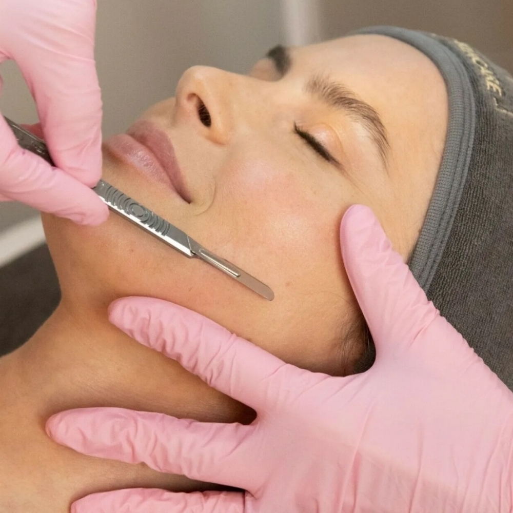 Dermaplaning at Aesthetics by Malory in Lubbock, TX