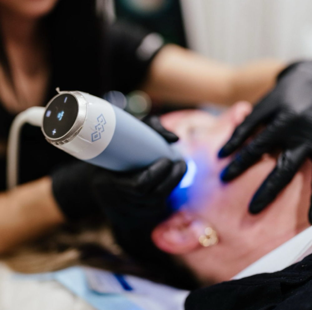 Exion Clear RF at ReGenerations Medi Spa in Radcliff, KY