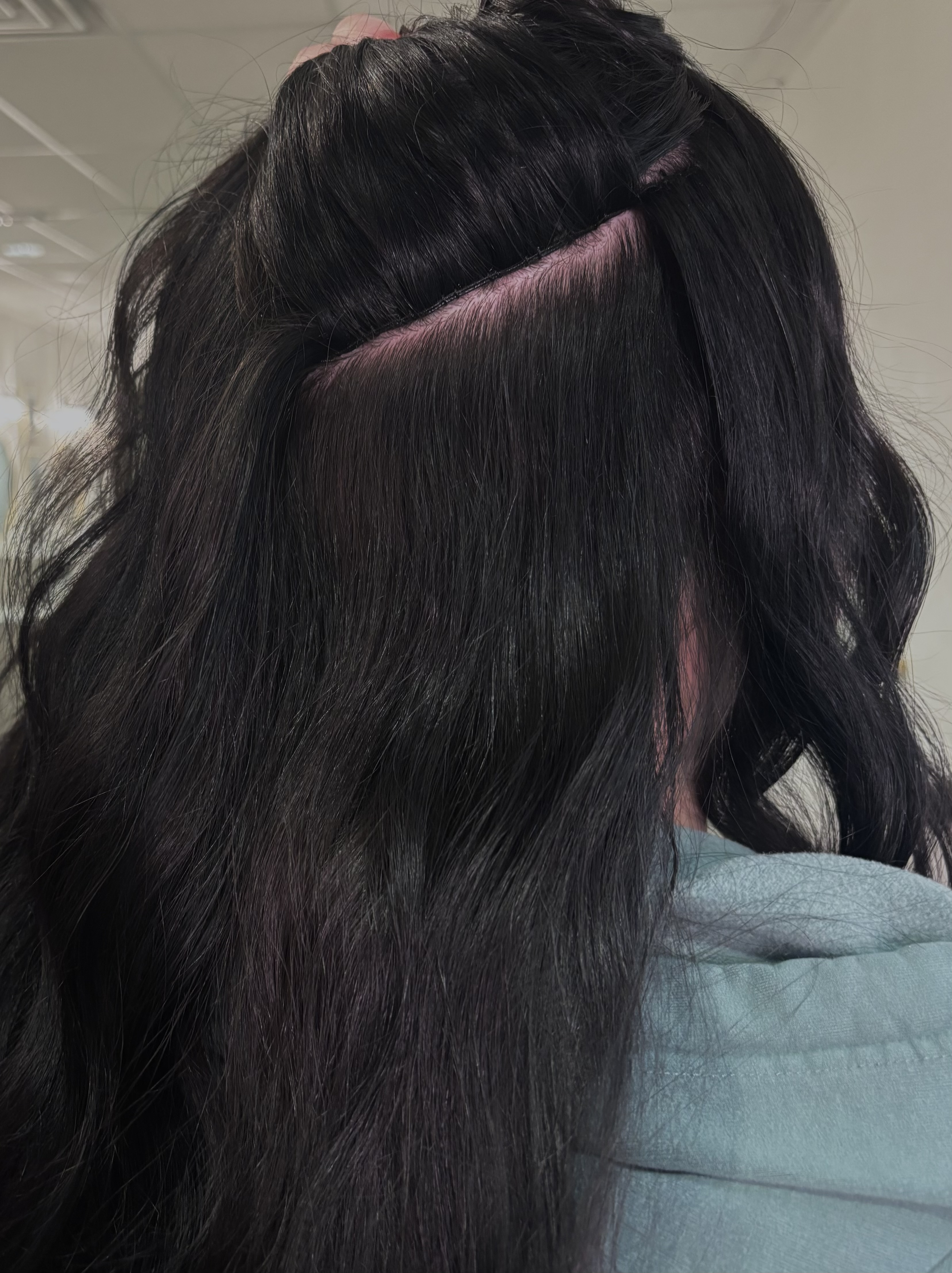 Extensions - Consultation