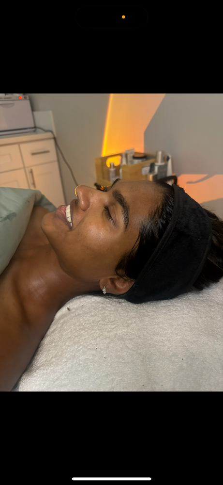 Dermaplane Facial