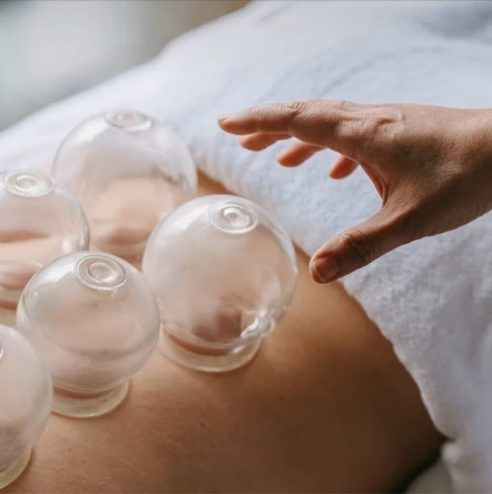 Cupping at Paradise Park Day Spa in Keaau, HI