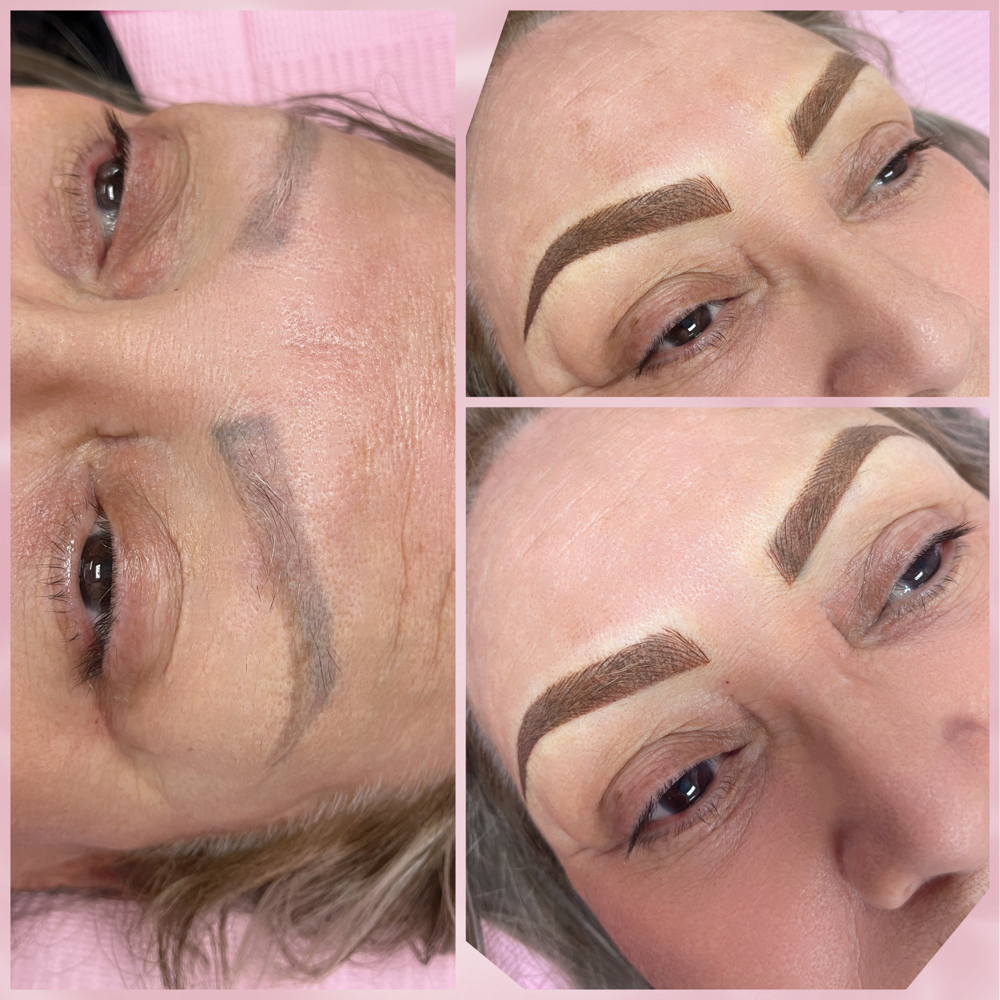 Brow Correction