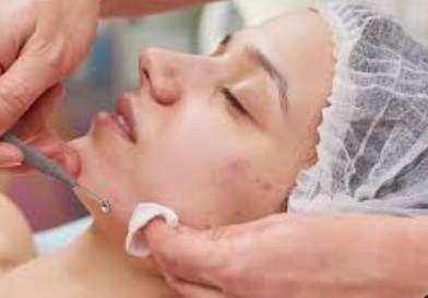 Acne-clearing Facial