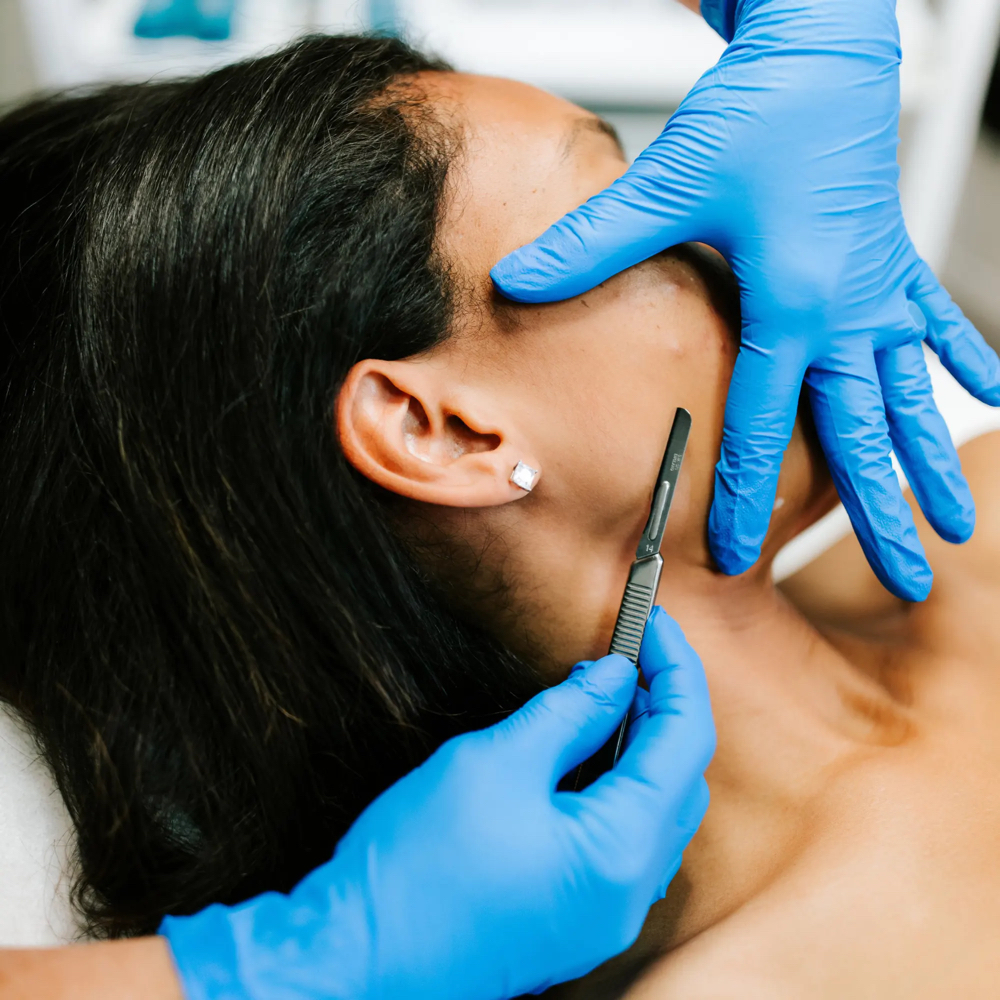 Dermaplane