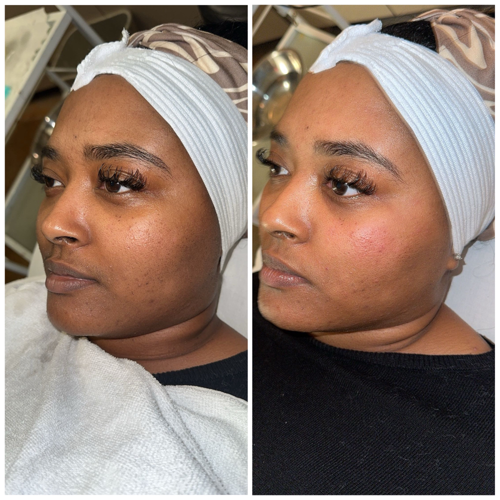 Silken Skin Facial
