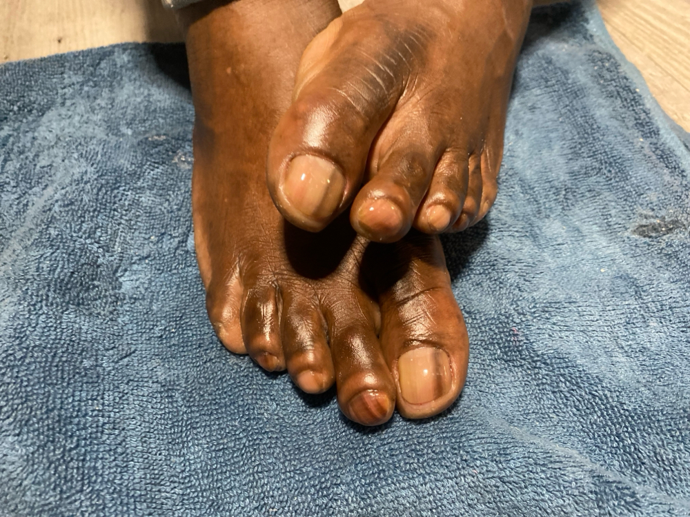 Foot Men