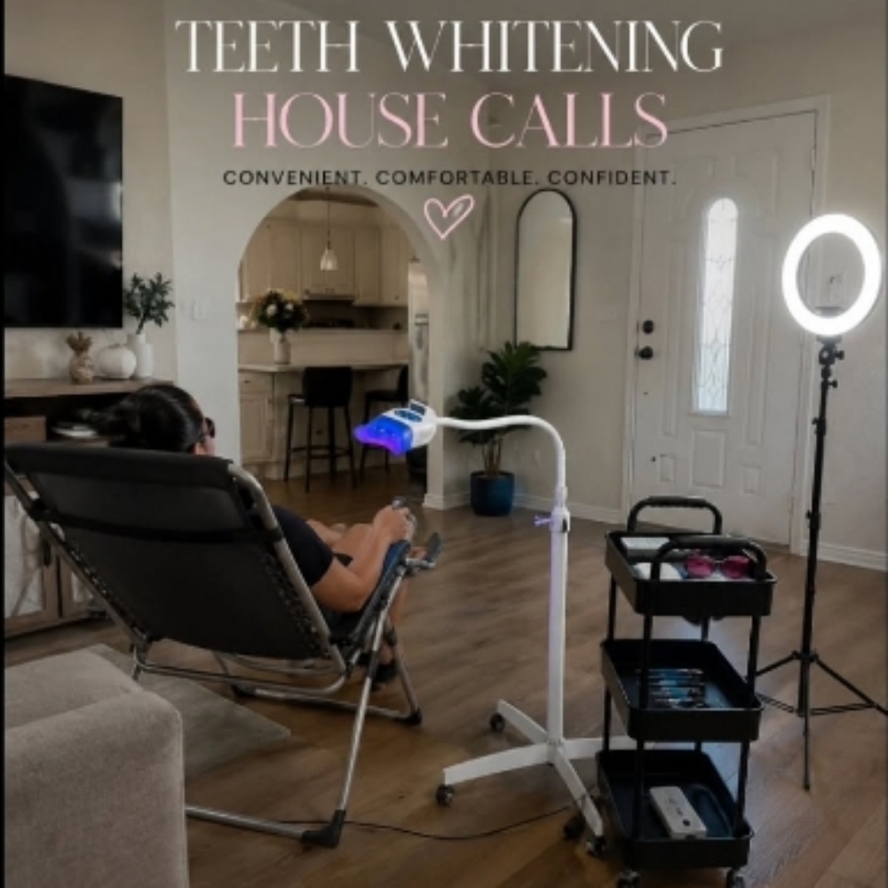 🚗 Mobile Service Available at Teeth Whitening Lounge in Santa Ana, CA