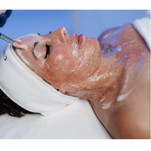 Beyond Botox Facial at LMK ESTHETICS SKINCARE SPA in Lake Ozark, MO