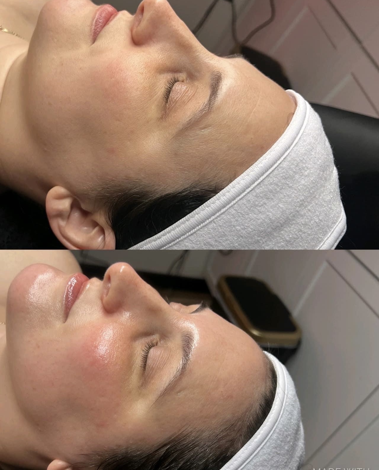 C-Bliss Infusion Facial