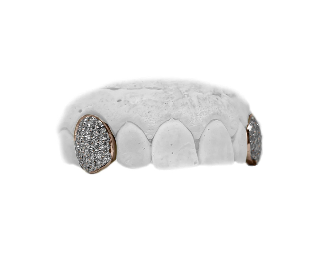 Impression Appointment For GRILLZ
