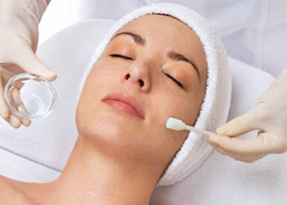 Chemical Peel