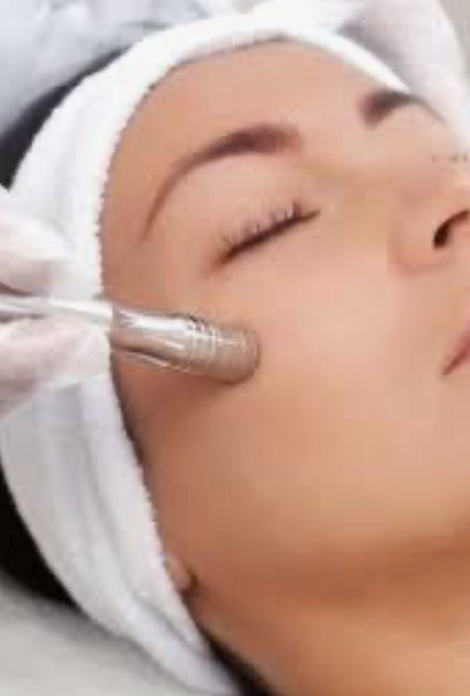 Microdermabrasion