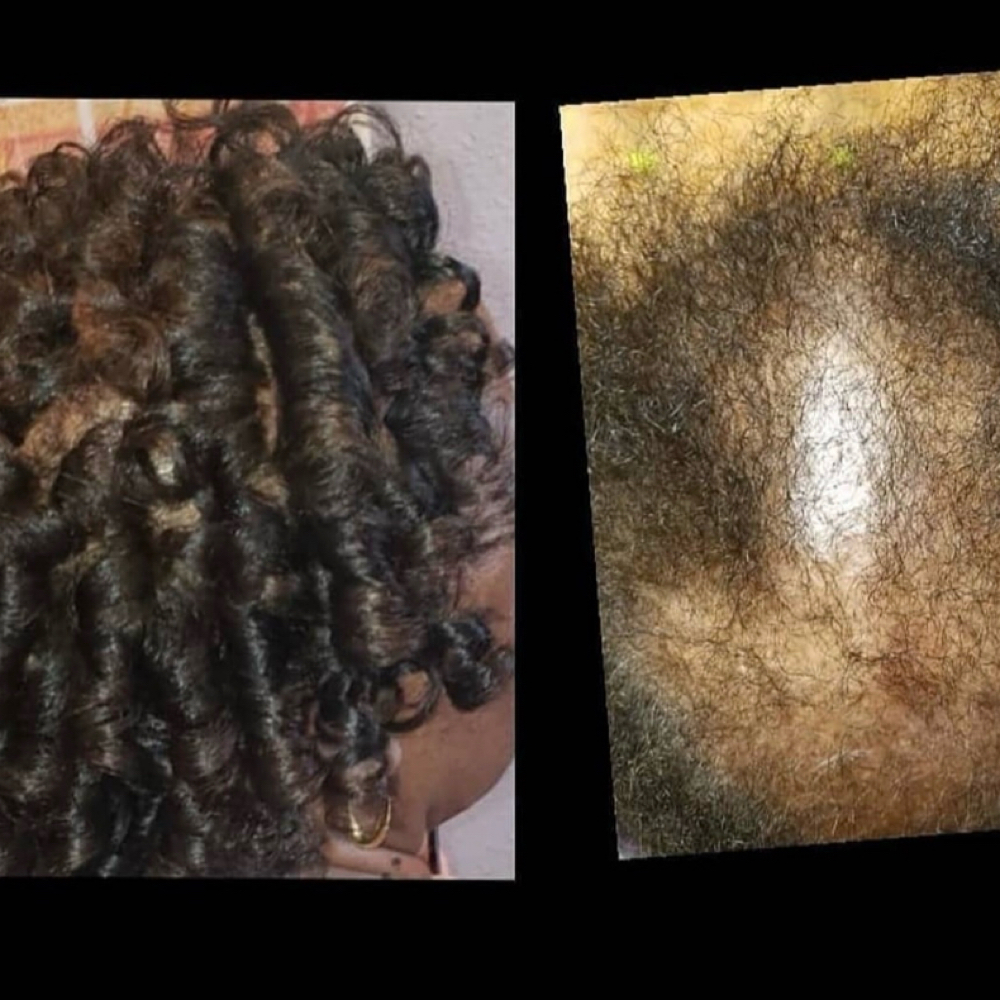 Hairloss/Scalp Consultation at Follicle Hair Solutions in Luling, LA
