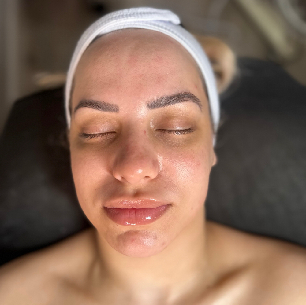 The Dream Facial at Aura Atelier in Charlotte, NC