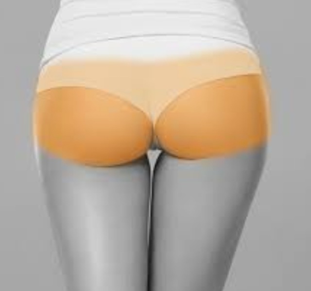 Laser hair Buttocks