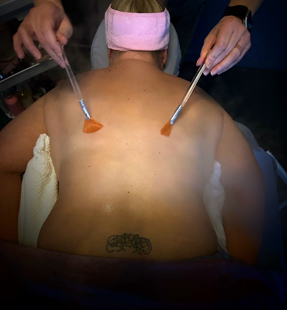Back Facial