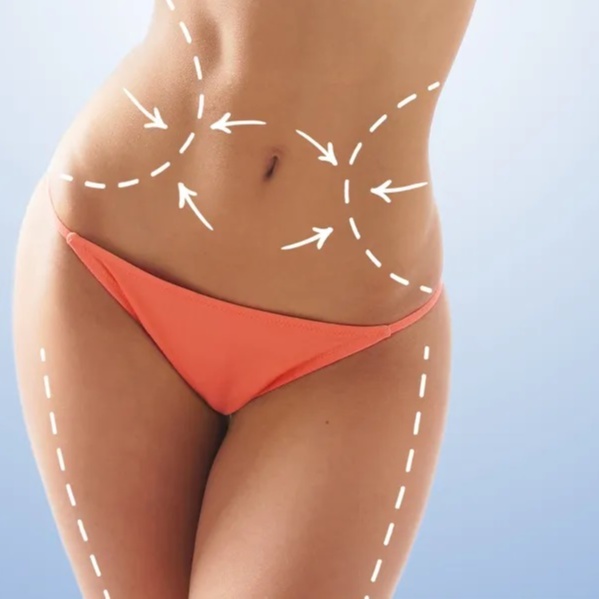PCDC Lipodissolve at BLUSH Aesthetics LLC in Laredo, TX