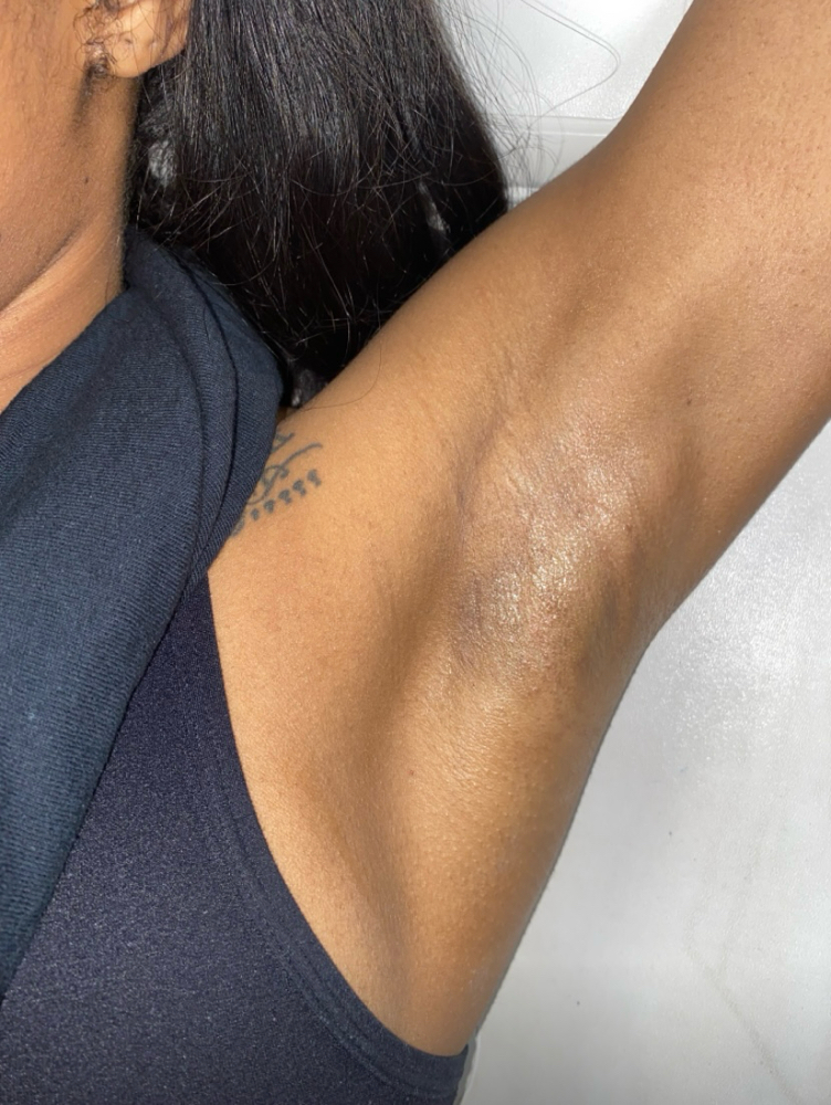 Underarms