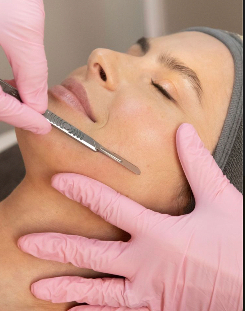 Dermaplaning