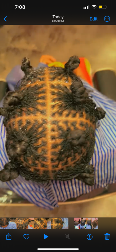 Micro Locs (Consult Required)