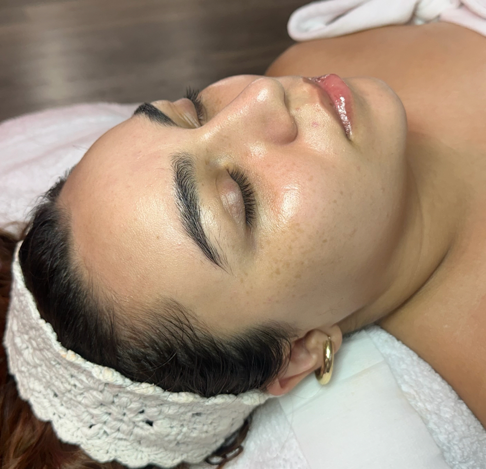 DERMAPLANE FACIAL