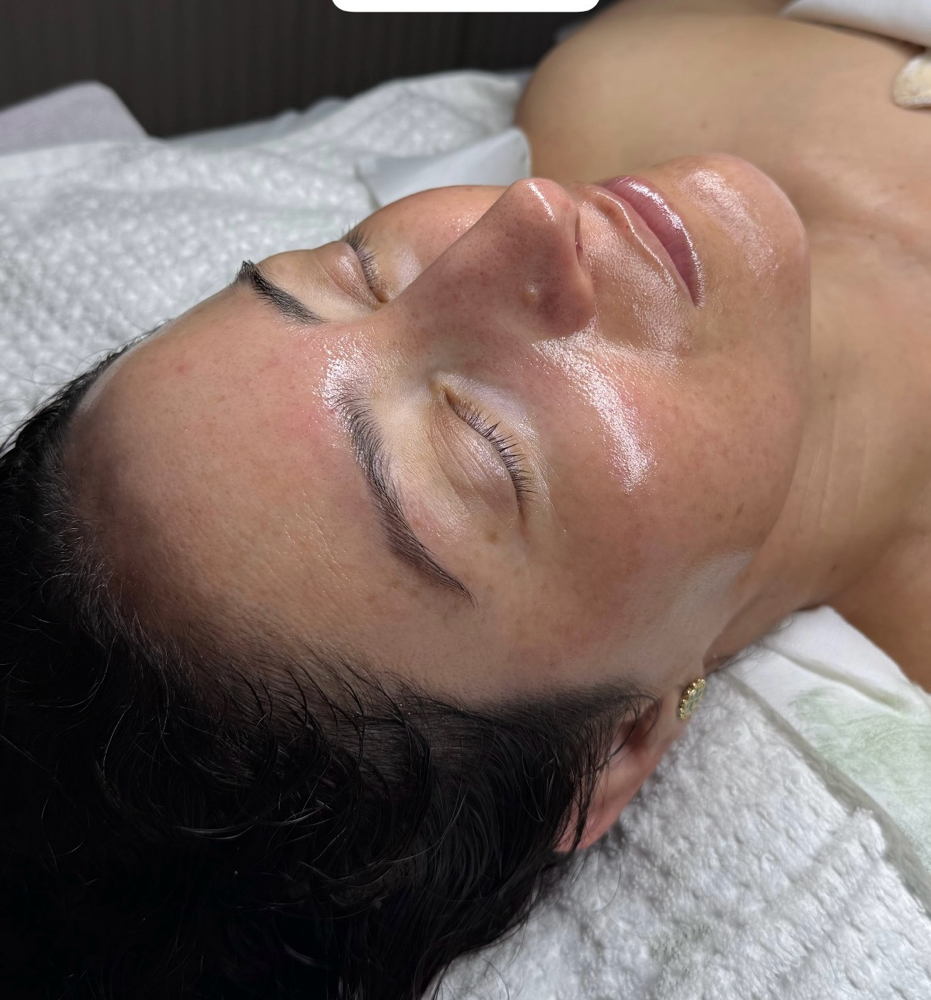 DERMAPLANE FACIAL