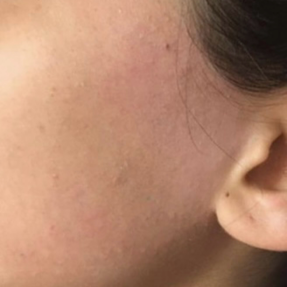 Side Burns at iSugar Waxing Studio in Redondo Beach, CA