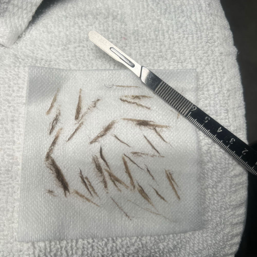 Dermaplane Add-On at Bliss Beauty & Aesthetics in Phoenix, AZ