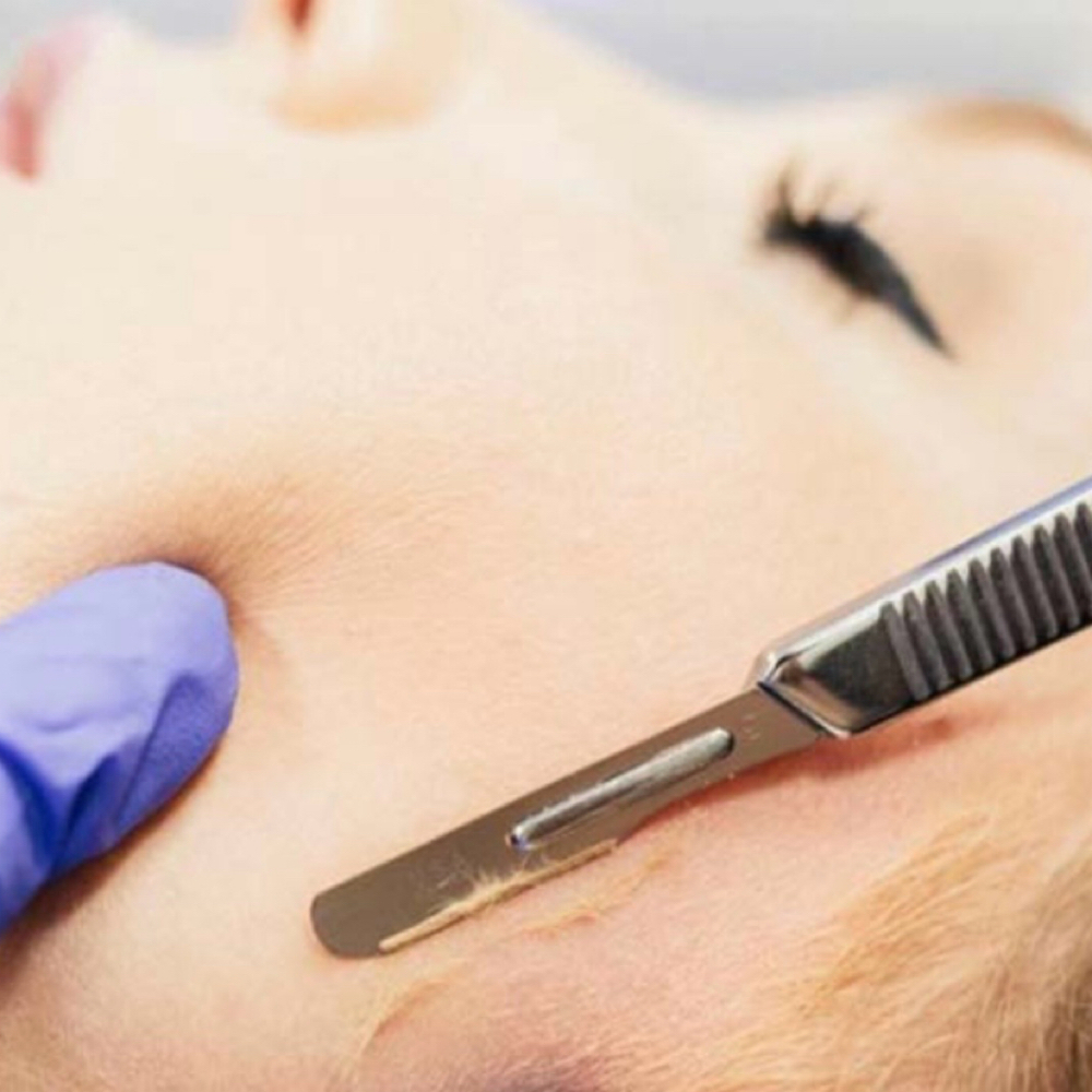 Dermaplane at Glamorous Beauty By Alisha Woodson in Jonesboro, AR
