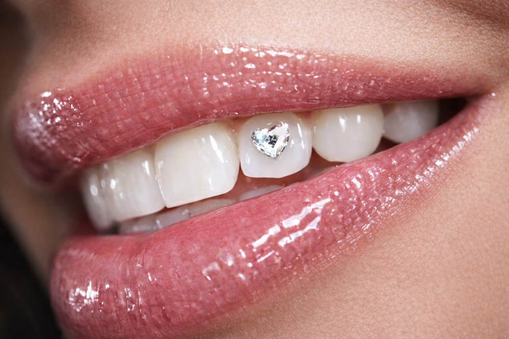 100% Austrian Crystal Tooth Gems