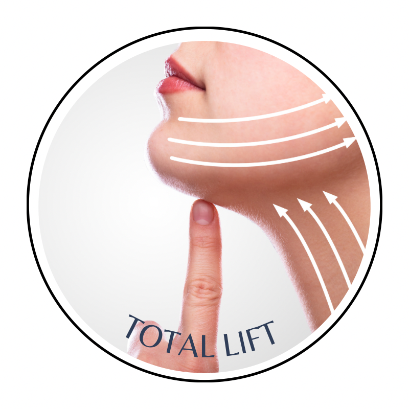 TOTAL LIFT-FUP